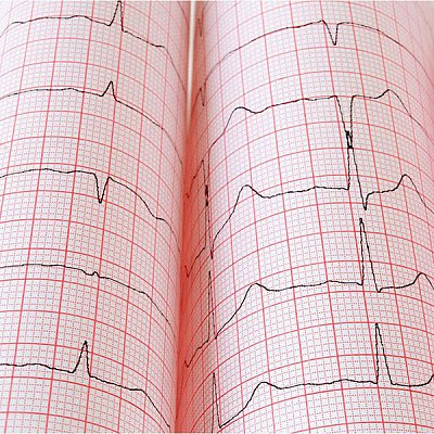 купить Бумага регистрационная для электрокардиографов SCHILLER CARDIOVIT AT-102