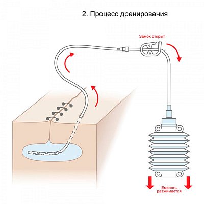 купить Набор для дренирования ран Mederen с катетером типа Редон