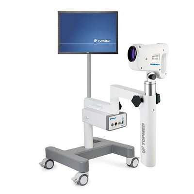 купить Кольпоскоп медицинский TOPMED Colposcope HD c принадлежностями